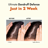 ALZIBA CARES Dandruff Care Scalp Moisturising Shampoo with Salicylic Acid,Tea Tree and D-Panthenol | for Dandruff Clean, Scalp Moisturise and Soft Hair | 200 ML | for Men and Women, All Season & all Hair Types