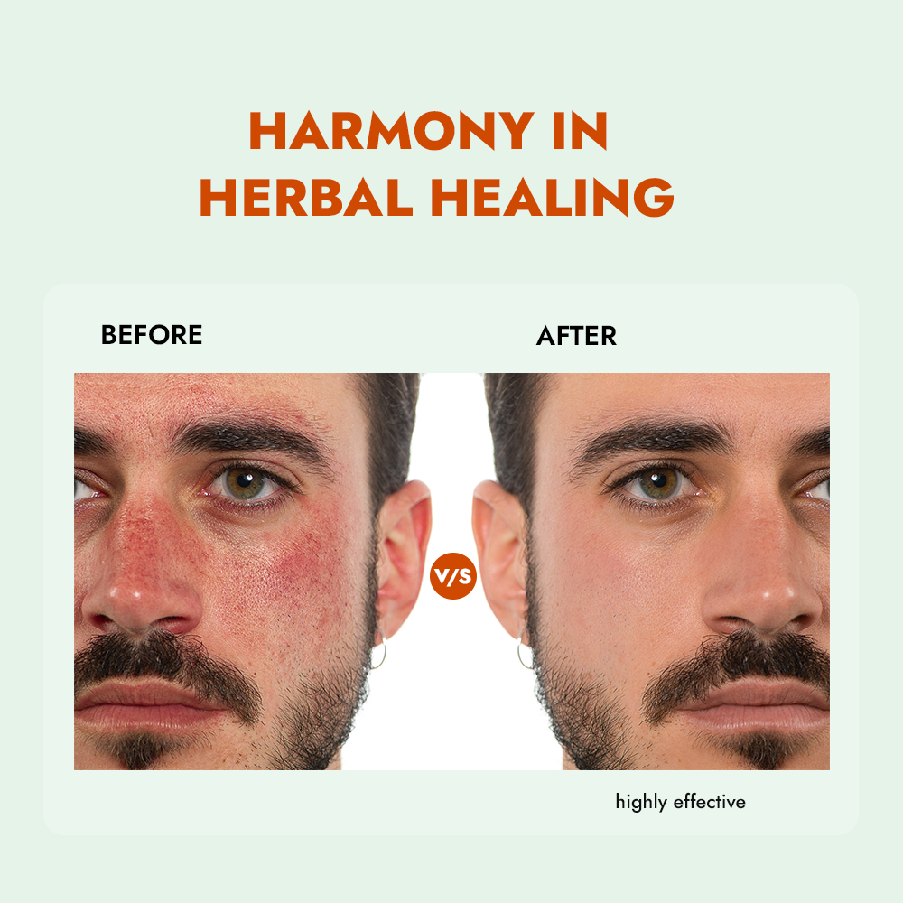 ALZIBA CARES Herbal Care Face wash with Mulberry, Liquorice, Tea Tree oil & D-Panthenol | for Soft, Supple & Balanced Skin | 100 ML | for Men and Women, All Season & all Skin Types ALZIBA CARES Herbal Care Face wash with Mulberry, Liquorice, Tea Tree oil & D-Panthenol | for Soft, Supple & Balanced Skin | 100 ML | for Men and Women, All Season & all Skin Types