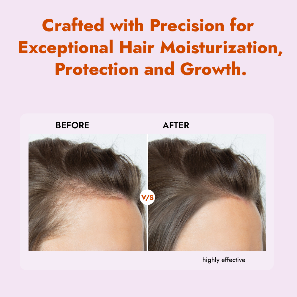 ALZIBA CARES Onion Black Seed oil Shampoo with Rosemary, Jojoba, Moringa, Coconut and Almond Oil | For Lenghthening & Nourishing Hair & Strong Hair | 500 ML | for Men and Women, All Season & all Hair Types ALZIBA CARES Onion Black Seed oil Shampoo with Rosemary, Jojoba, Moringa, Coconut and Almond Oil | For Lenghthening & Nourishing Hair & Strong Hair | 500 ML | for Men and Women, All Season & all Hair Types