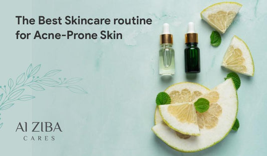 The Best Skincare routine for Acne-Prone Skin - ALZIBA CARES