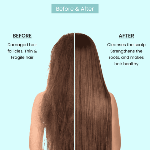 Hair Fall Control Shampoo With Bhringraj & Olive Oil (Keratin Therapy) – 200ML - ALZIBA CARES